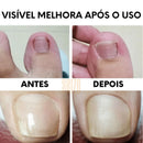 ElasticCorrect™  -  Compre 25 e Leve 50 unidades